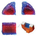 vocal folds