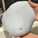 3D Printing Enhances Breast Reconstruction Surgery Efficiency