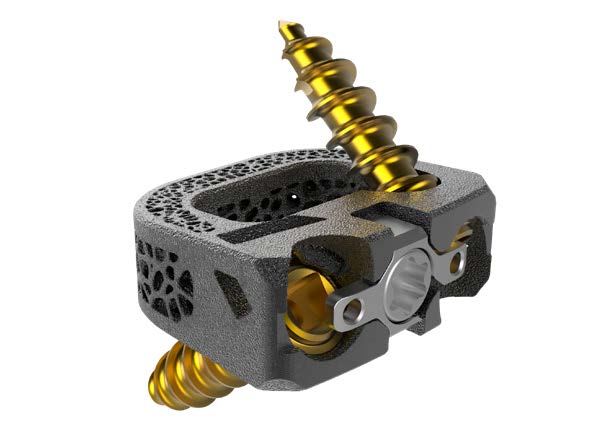 Innosys’ UniSpace Cervical Cage Receives FDA Approval