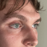 3D Printed Ocular Prostheses to Redefine Quality Standards