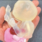 How 3D Printing Labs Boost Effectiveness of Radiology