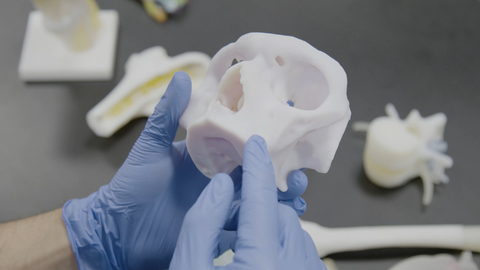 Stratasys and Ricoh Launch Clinical Study on 3D Printed Models in Orthopedic Oncology